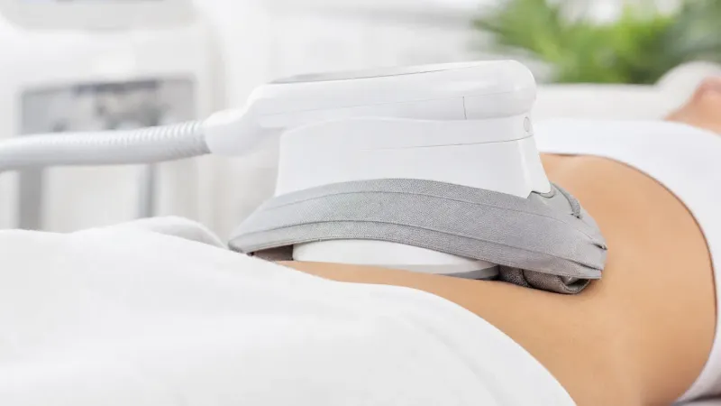 Криолиполиз в Санкт-Петербурге: аппараты CoolSculpting и альтернативы для коррекции фигуры