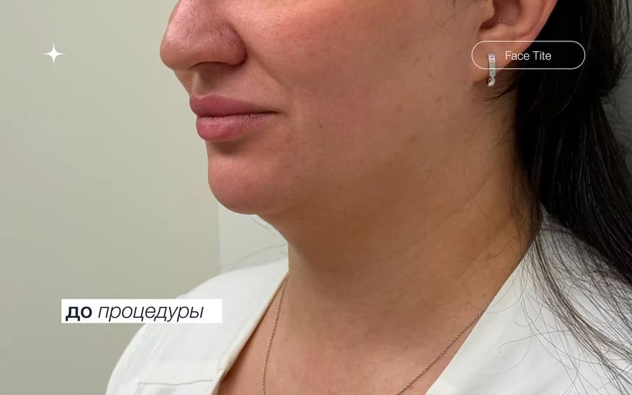 До процедуры